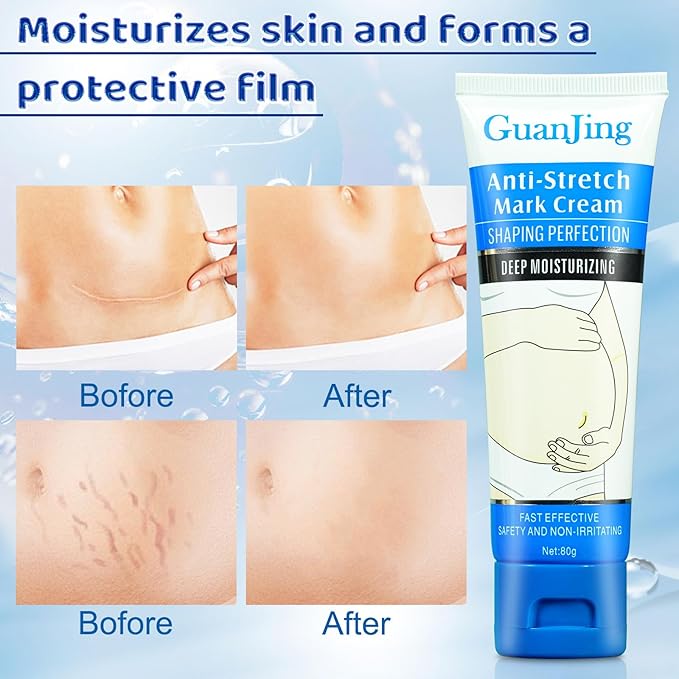 Stretch Mark Cream Stretch Mark Oil for Pregnancy, Stretch Mark Removal Belly Butter for Pregnant Women To Prevent And Repair Maternity Stretch Marks Scar Cream 2.82 Oz Skincare Body Oil 4.2 Fl.oz-Velvo Beauty