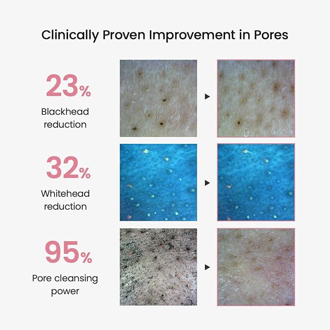 BIODANCE Collagen Cleansing Oil, Facial Oil Cleanser, Gentle Makeup Remover without Clogging Pores, Removes Bleackhed and Whitehead for Sensitive Skin, Oily Skin, Korean Skincareㅣ6.76 fl. oz. (200 ml)-Velvo Beauty