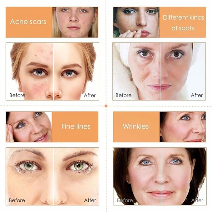 Vitamin C 5-Piece Skincare Set with Cleanser, Toner, Serum, Eye Cream and Face Cream for Skin Brightening skin care set skincare gift set skin care set for Unisex Adult-Velvo Beauty