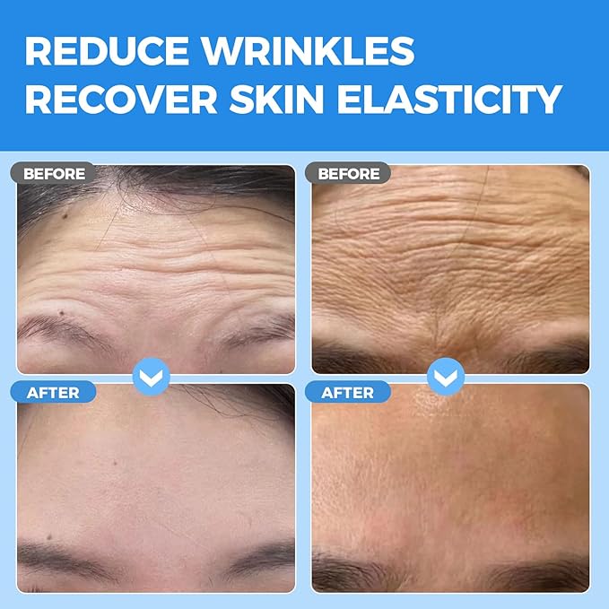 Okela Forehead Wrinkle Patches Overnight 20 pcs with Collagen, Anti Wrinkle Patches, Forehead Wrinkles Beauty Treatment-Velvo Beauty