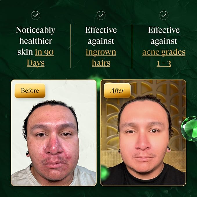 douxds Flex™ Pro Vibrating Face Brush, Electric Face Scrubber, Face Scrubber for Men, Flex™ Face Brush, Men's Skin Care, Powerful Sonic Technology, Removes Dark Marks and Bumps, Acne Treatment-Velvo Beauty