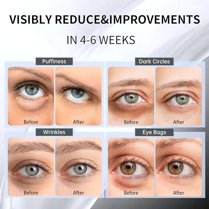 Advanced Snail Hydrogel Eye Patch 60 Patches, Gel Serum Mask, Undereye Treament, Fine Lined, Puffy Eyes, Refresh, Hydrate, Paraben free, Phthalates free, Skincare-Velvo Beauty