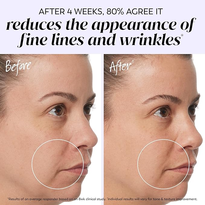 Olay Retinol 24 Face Moisturizer, Anti-Aging Night Cream for Women, Fragrance-Free, Non Greasy - Anti-Wrinkle, Smooth Fine Lines, Tightening, Hydrating Skin Care - Peptides, Glycerin, 1.7 Oz-Velvo Beauty