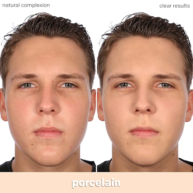 Almay Clear Complexion Acne Foundation Makeup with Salicylic Acid - Lightweight, Medium Coverage, Hypoallergenic, Fragrance-Free, for Sensitive Skin, 099 Porcelain, 1 fl oz.-Velvo Beauty