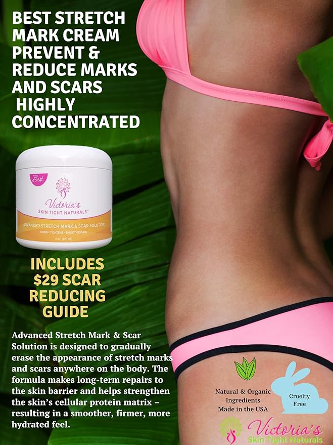 Best Stretch Marks Cream Prevent & Reduce Marks Reduce Pregnancy Stretch Marks Highly Concentrated Cream includes $29 Scar Reducing Guide-Velvo Beauty