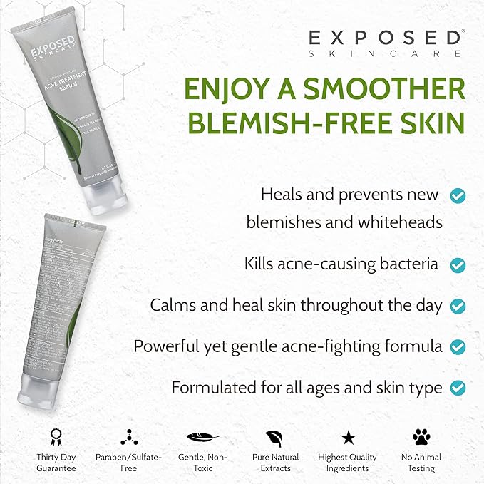 Exposed Skin Care Acne Treatment Serum Step 3 – Quickly Reduces Pimple Size and Redness - 12 Hour Spot Treatment - 3.5% Benzoyl Peroxide, Natural Green Tea & Tea Tree Oil-Velvo Beauty