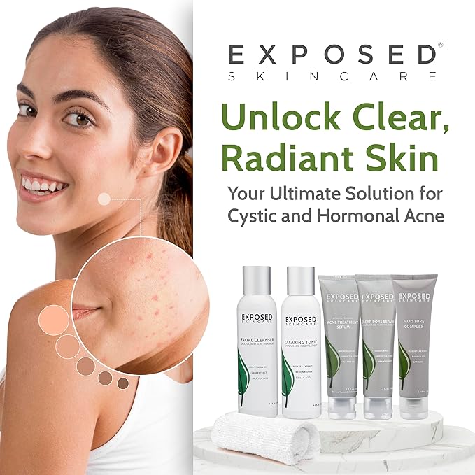 Exposed Skin Care Expanded Acne Treatment Kit - Includes Salicylic Acid Face Wash, Clearing Tonic, Treatment Serum with Benzoyl Peroxide, Clear Pore Serum, Moisture Complex - Made for All Skin Types-Velvo Beauty