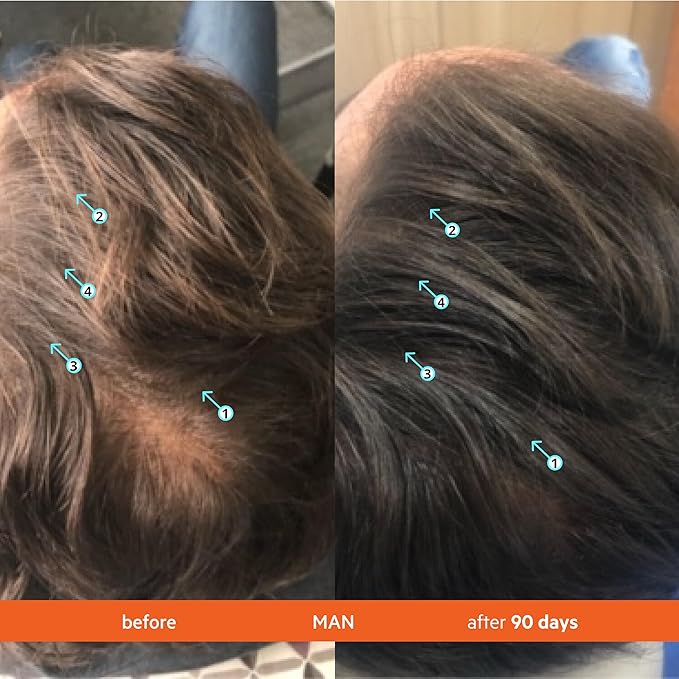 DS Labs Revita Shampoo Travel Size – High-Performance Hair Density Shampoo, Volumizing & Thickening, Fuller, Healthier-Looking Hair, Sulfate & Silicone Free, For Men & Women, 100mL-Velvo Beauty