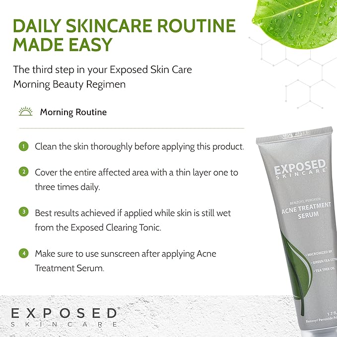 Exposed Skin Care Acne Treatment Serum Step 3 – Quickly Reduces Pimple Size and Redness - 12 Hour Spot Treatment - 3.5% Benzoyl Peroxide, Natural Green Tea & Tea Tree Oil-Velvo Beauty