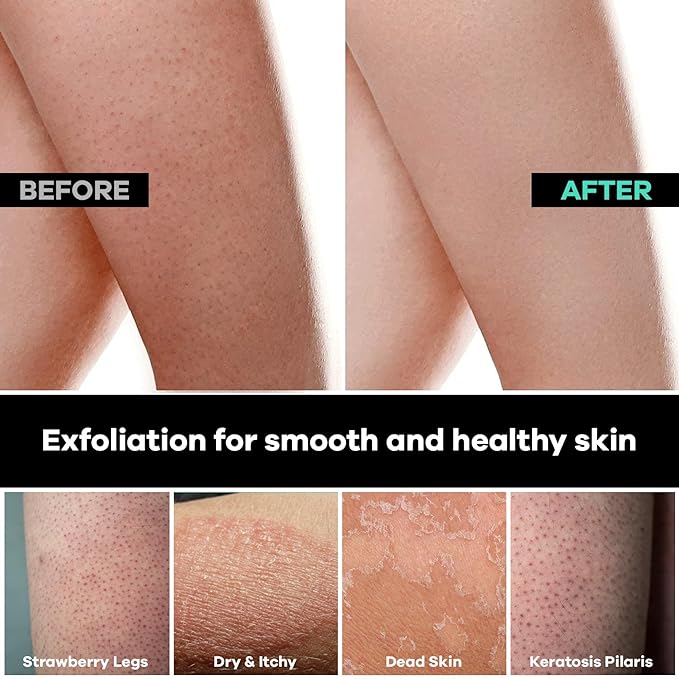 Dermasuri Deep Exfoliating Glove for Shower - Scrubbing Mitt Body Scrubber Gloves Skin Exfoliator & Eliminates Dead Skin - Keratosis Pilaris Scrub Spray Tan Remover - Korean Skincare for Body (2 Pack)-Velvo Beauty