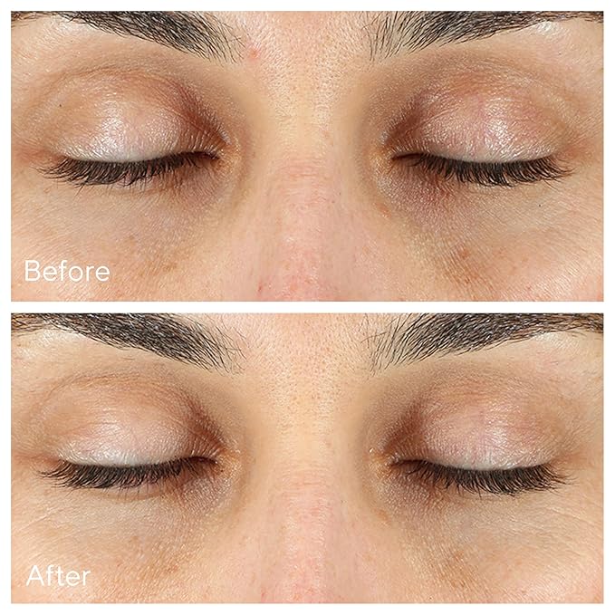 Murad Vita-C Eyes Dark Circle Corrector – Environmental Shield Vitamin C Brightening Serum – Anti-Aging Treatment for Puffiness and Wrinkles, 0.5 Fl Oz-Velvo Beauty