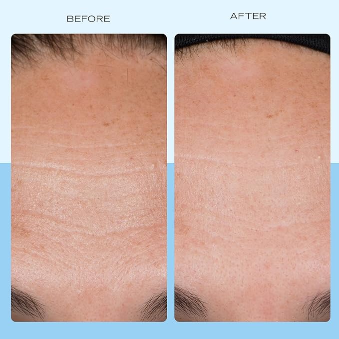 First Aid Beauty Firming Collagen Cream with Collagen, Peptides and Niacinamide – Day + Night Anti-Aging Face Moisturizer – 1.7 fl oz-Velvo Beauty