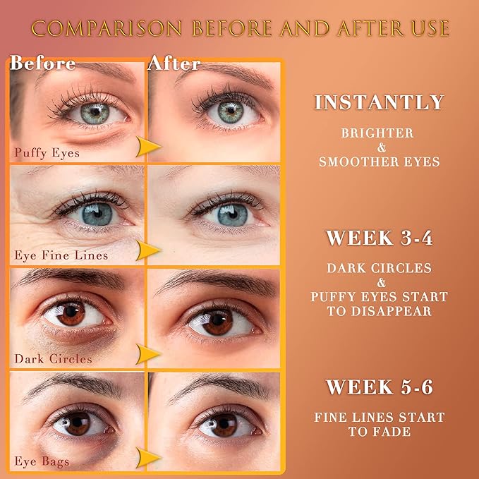 24K GOLD Eye Mask– 60 Pcs - Gold Under Eye Mask Retinol & Collagen - Puffy Eyes and Dark Circles Treatments – Look Younger and Reduce Wrinkles and Fine Lines Undereye-Velvo Beauty