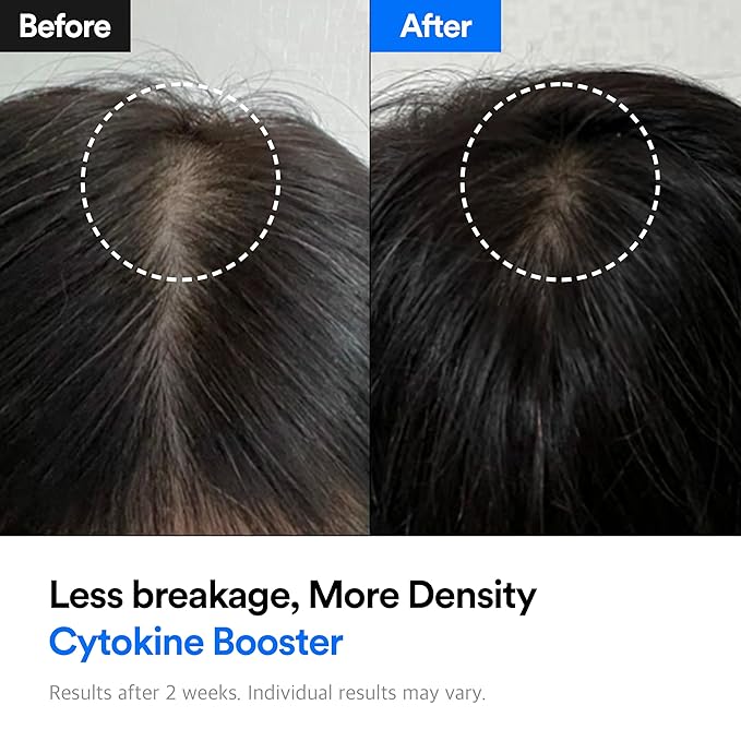 Hair-Recovery Cytokine Booster, 3.38 Fl.Oz.– Hair Regrowth Tonic for Thinning Hair, Hair Loss Treatment, Stimulates Follicles, Thicker, Stronger Hair (Sensitive)-Velvo Beauty