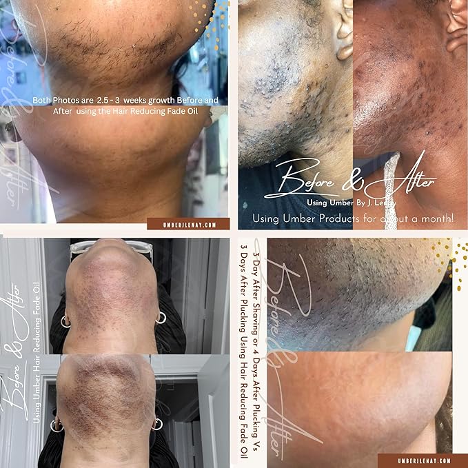 Hair Reducing Fade Oil - Sentive Strength (For sentive skin) Hair Growth Minimizer, Slow Down Facial Hair Growth for Women & Men, Hair Inhibitor Serum, Moisturizing & Soothing, 15ml-Velvo Beauty