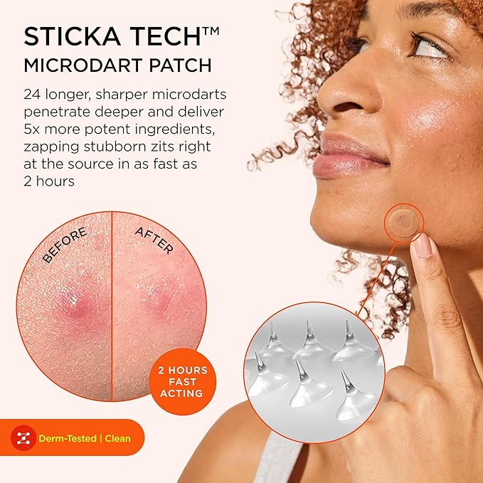 ZitSticka Extra Strength Killa Acne Patches for Face - World's Most Potent Pimple Patch with Fast-Acting Microdarts - Starts Working within 2 Hours for Deep, Early-Stage Zits & Blemish - 20 Count-Velvo Beauty