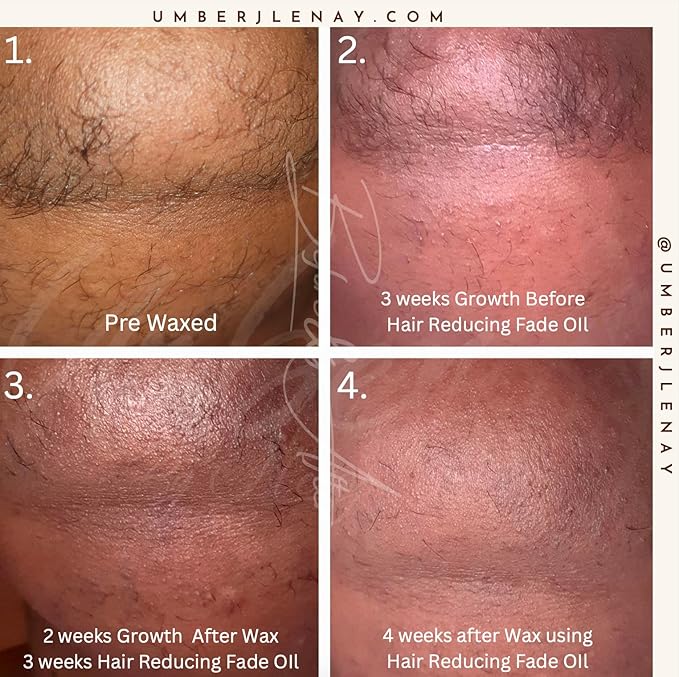 Hair Reducing Fade Oil – Regular Strength (Not sensitive skin), Minimizes Hair Growth for Face & Body – For Women & Men – 15ml Serum-Velvo Beauty