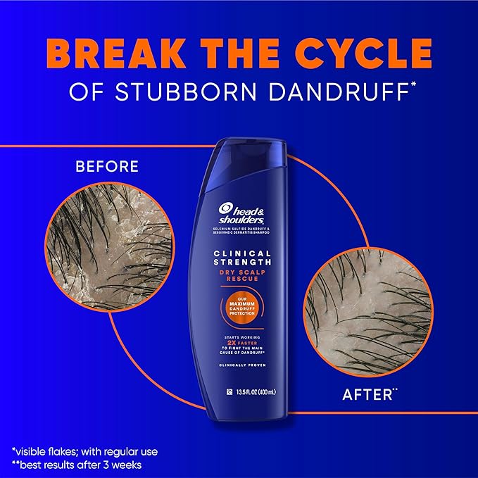 Head & Shoulders Clinical Strength Dandruff Shampoo and Conditioner Set, Dry Scalp Relief, Up to 100% Flake Protection, Selenium Sulfide Formula, 13.5 & 9.1 Fl Oz, 2 Pack-Velvo Beauty