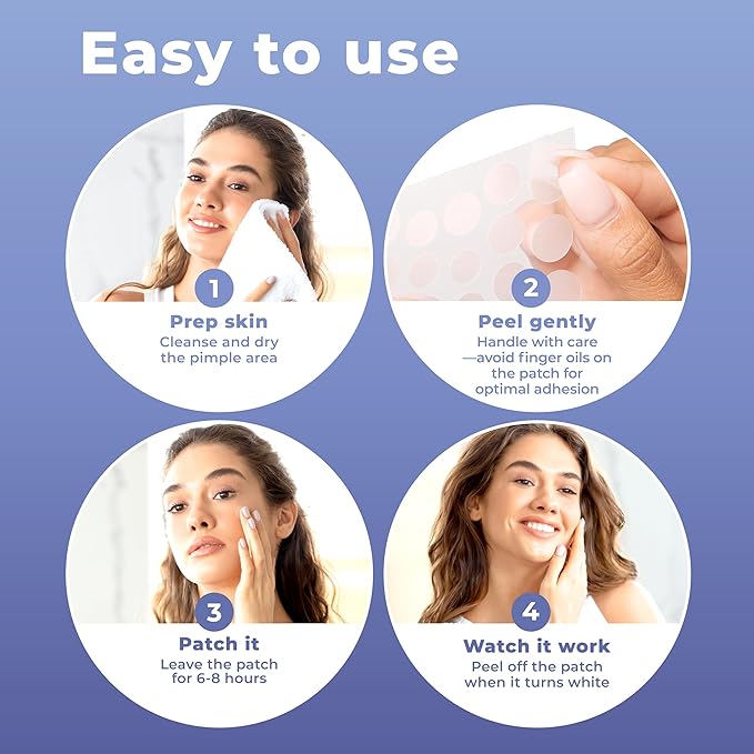 Pimple Patches for Face (240 Patches), Hydrocolloid Acne Patches with Tea Tree Oil & Salicylic Acid, Pimple Patch Pimple Stickers, Hydrocolloid Patch Acne Dots Acne Pimple Patches For Face-Velvo Beauty