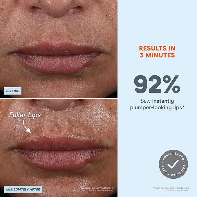 NuFACE FIX MicroWand Microcurrent Facial Device, FDA Cleared - Eyes, Lips & Lines Treatment with Serum Activator - Lip Plumper, Eye Depuffing Wand, Wrinkle & Smile Line Reducer, 3 On-the-Go Modes-Velvo Beauty