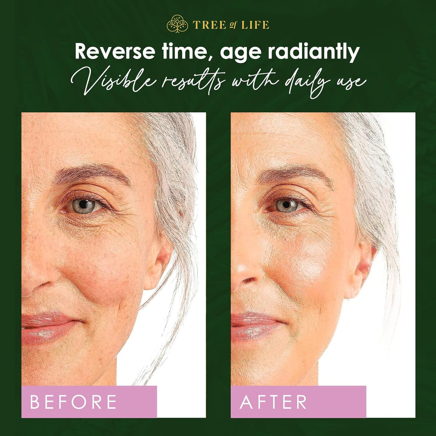 Tree of Life Beauty Retinol Serum, Skin Smoothing Face Oil for Dark and Age Spots and Fine Lines, Facial Serums for Dry and Sensitive Skin Care with Hyaluronic Acid for Soft Smooth Skin, 2 Fl Oz-Velvo Beauty