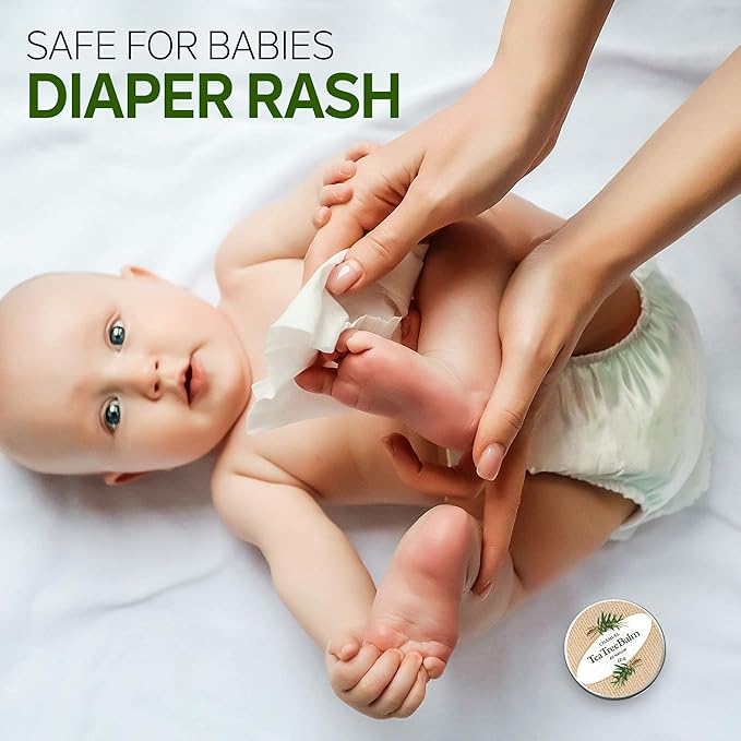 Tea Tree Oil Balm -100% All Natural | Great Cream for Soothing Irritations like Rashes, Insect Bites, Folliculitis, Acne, Itches, Dry Heels, Cuticles, Saddle Sores and more!-Velvo Beauty