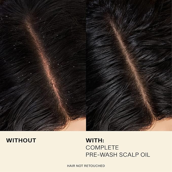 JVN Pre-Wash Scalp Oil & Hair Treatment Oil, Pre Shampoo Dry Scalp Treatment, Scalp Cleansing Oil for All Hair Types, Sulfate Free (1.7 Fl Oz)-Velvo Beauty