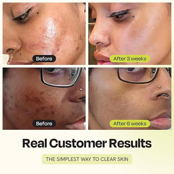 Gleamin Vitamin C Clay Mask for Dark Spots, Turmeric Clay Face Mask Skin Care, Deeply Cleanses & Refines Pores, Brightens Uneven Tone and Helps Improve Post-Blemish Scarring & Texture, Up to 20 Uses-Velvo Beauty