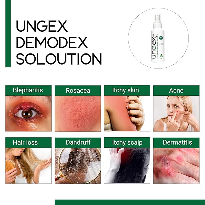 Basic Kit-i | Demodex Solution For Acne Rosacea, Itchiness, Redness | Ungex-Velvo Beauty