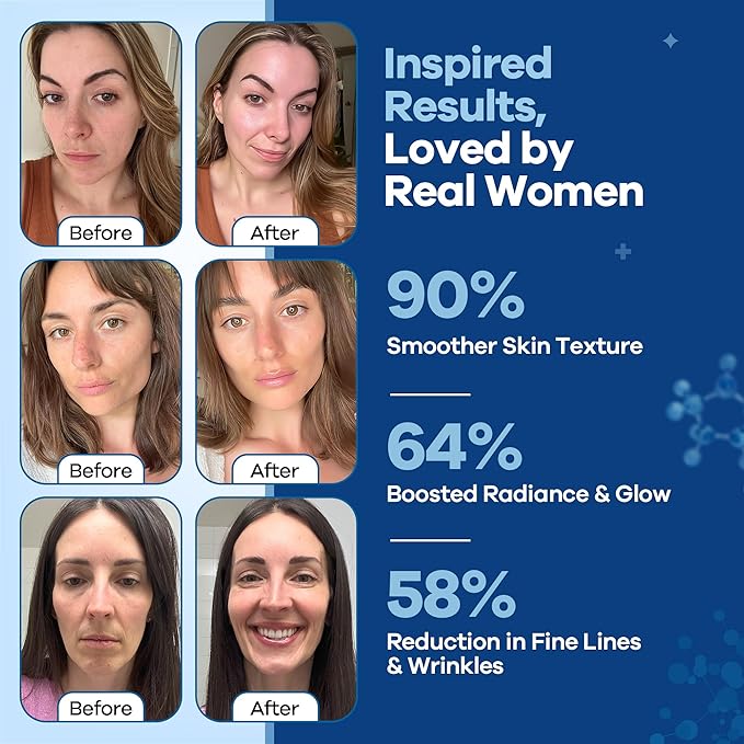 TURMSKIN® Hyaluronic Acid Serum Ampoules [ULTRA HYDRATING VIALS] - 3% Hyaluron Booster for Glass Skin & Anti Aging - 24 Hours Hydration - Soft PE Triple Hyaluronic Complex for Faceskin Repair & Renew-Velvo Beauty