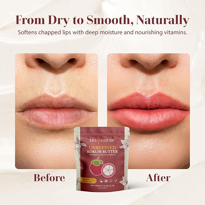 era of nature Kokum Butter Raw - 32 oz (2lb) – Natural Butter for Body Butters, Lotion Bars, Lip Balm, Soap Making – Blends Well with Shea or Cocoa Butter – For Stretch Marks, Scars, Pregnancy Care-Velvo Beauty