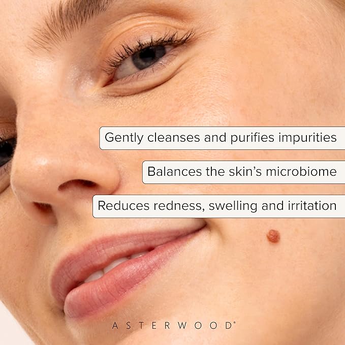 Asterwood Hypochlorous Acid Spray for Face - Targets Acne, Redness, Irritation - Multi-Purpose Skin Repair - Antibacterial, Antimicrobial - After Gym/Post-Workout Facial Mist - 4 Fl Oz-Velvo Beauty