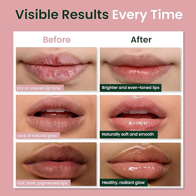 Vegan Lip Balm for Dull, Dark & Smokers' Lips | Naturally – Hydrating & Moisturizing - Antioxidant-Rich-Velvo Beauty