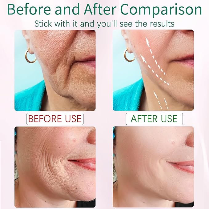 7-in-1 Red-Light-Therapy-for-Face and Neck, Face Neck Massager for Daily Skin Care Routine-Velvo Beauty