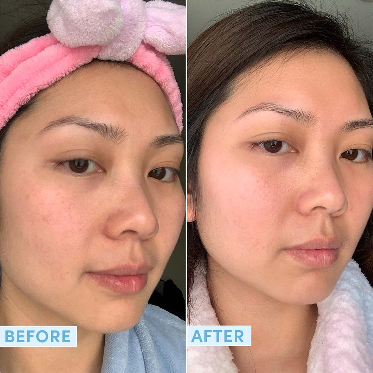 Sand & Sky Tasmanian Spring Water Hydrating Serum with Hyaluronic Acid & Probiotics - Fine Line Reducing Face Serum, Plumps Skin & Smooths Wrinkles, 1 fl oz-Velvo Beauty