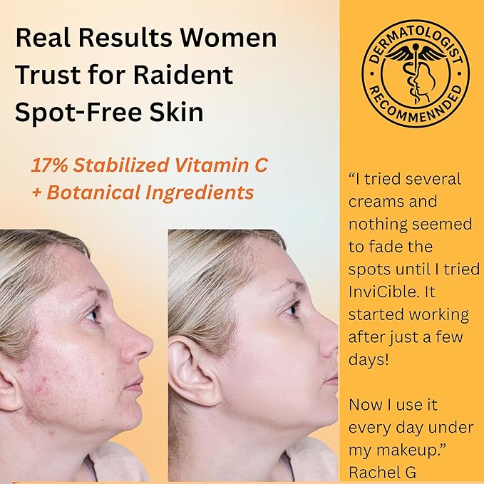 5 in 1 Primer For Face Before Makeup | 17% Vitamin C | All Day Grip | Dark Spot Corrector | Silky Matt Finish | Chemical Free | Vegan | All Skin Types | Made in America | 1fl oz-Velvo Beauty