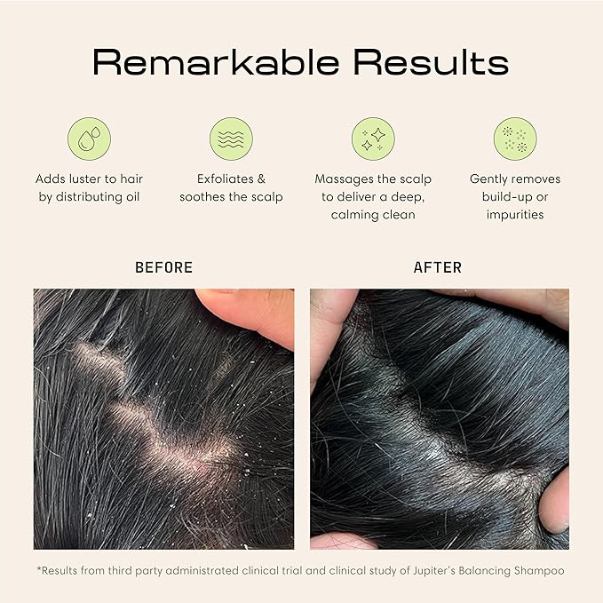 Jupiter Exfoliator Brush For Removing Dandruff & Build-Up - Detangling Scrubber For Wet or Dry Hair - Supports Circulation & Growth - For All Hair Types - Black, 2 Pack-Velvo Beauty