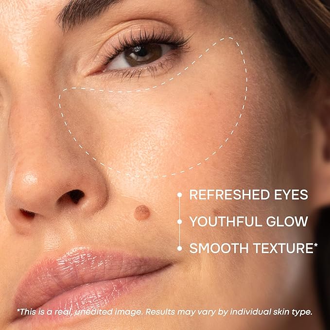 Under Eye Patches for Puffy Eyes and Dark Circles - Cooling Eye Masks for Women & Men with Collagen, Hyaluronic Acid & Retinol - Depuffing Undereye Mask Patches - Parches Para Ojeras - 15 Pairs-Velvo Beauty