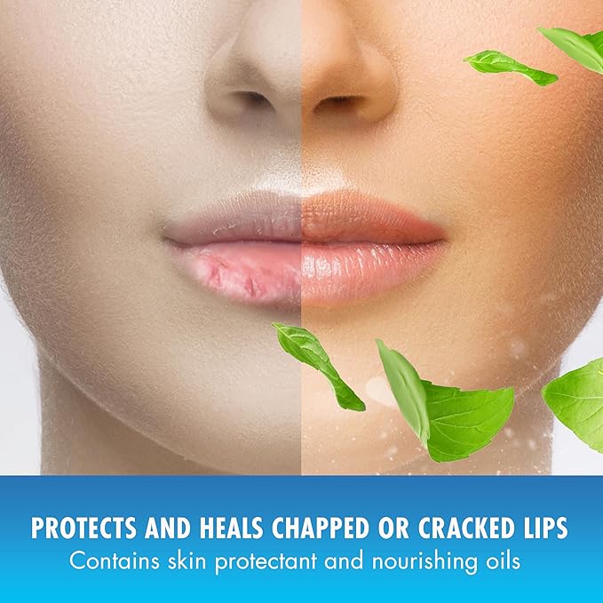 Natural Ice Original SPF 15 Medicated Lip Balm - 12 Count Pack-Velvo Beauty