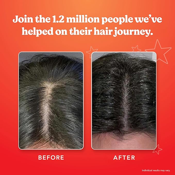 HAIRtamin Scalp Serum Natural Hair Growth Thickening | Made in USA | Helps Increase Hair Thickness and Aids Against Hair Thinning and Hair Fall Out | Moisturizes and Soothes Dry Itchy Scalp-Velvo Beauty
