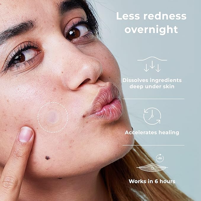 OMMA Korean Microdart Acne Patch, Cystic Acne Treatment, Micropoint Pimple Patches for Face for Early-Stage Painful Zits, Salicylic Acid & Tea Tree - 14 mm Zit Stickers (18 Count)-Velvo Beauty