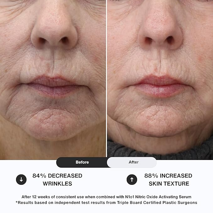 Moisturizer Face Cream - Day & Night Face Moisturizer with Nitric Oxide, Peptide Complex, Epidermal Growth Factor - Tightening & Firming Skin Care Products for Wrinkles, Dark Spots - 1.75 oz.-Velvo Beauty