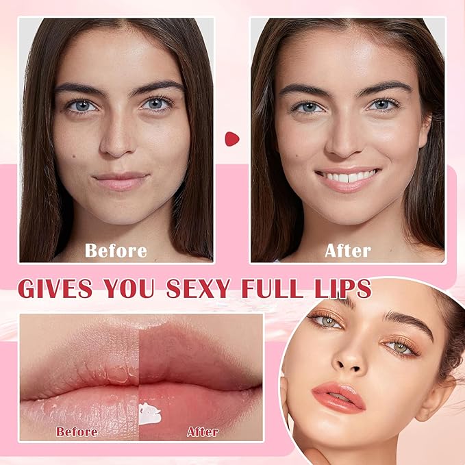 Honey Lip Balm (Strawberry, Watermelon) - Smooth, Hydrating Propolis Lip Mask Overnight Scrubs Exfoliator, Natural Ingredients, Lip Care Set-Velvo Beauty