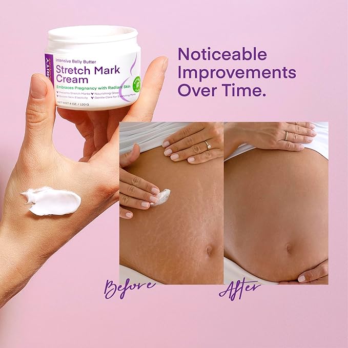 Stretch Mark Cream for Pregnancy: Stretch Mark Treatment - Belly Butter For Pregnant Women - Massage Lotion To Prevent And Repair Maternity Stretch Marks Scar - 4 Oz-Velvo Beauty