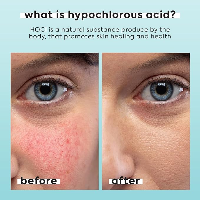 Hypochlorous Acid Spray for Face & Body - Helps Reduce Redness and Breakouts - Travel Size Hypochlorous Spray, Multi-Purpose Topical Facial Skin Repair, pH-Balancing Toner - TSA, Livaclean-Velvo Beauty