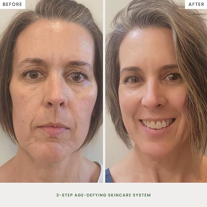 The Spa Dr. 3-Step Age-Defying Skincare System - Antiaging SkinCare Set for Women - Anti Aging Skin Care Sets for Women - Skin Care Routine: Cleanser, Age Defying Lift & Tight Serum, Moisturizer-Velvo Beauty