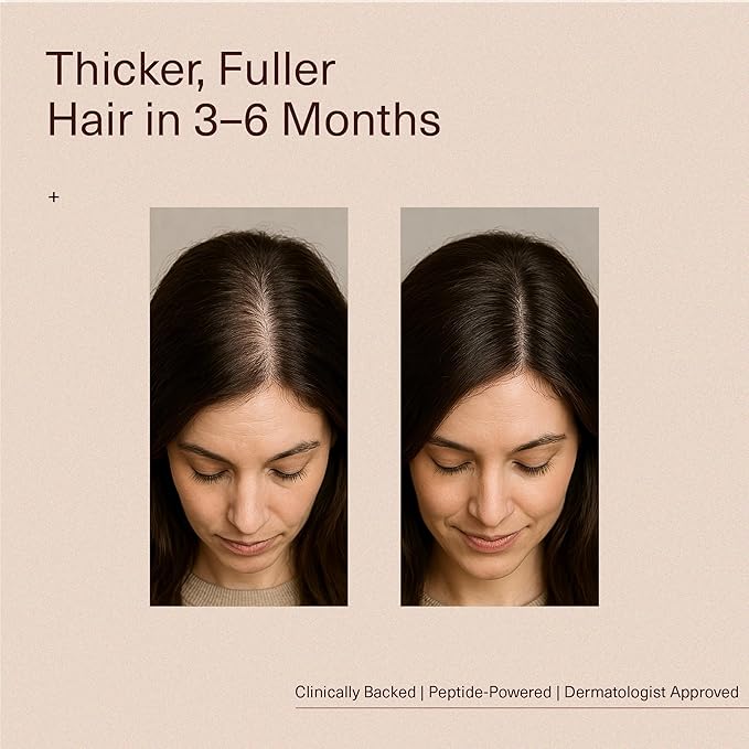 Bloom Peptide Hair Serum with Advanced Multi-Peptides for Women with Thinning Hair, Promotes Fullness, Reduces Shedding, & Balances Scalp, Lightweight, Non-Greasy (Pack 1) 30ml-Velvo Beauty