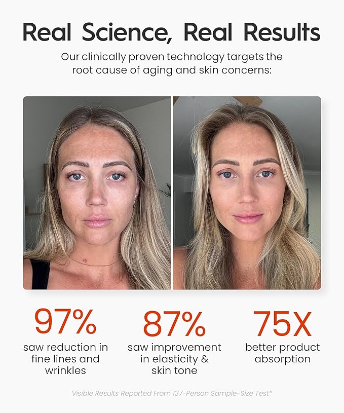 REVO Genie | Face & Neck Beauty Massager with Ultra Powerful LEDs for Wrinkles, Fine Lines, Puffy Skin, Uneven Skin Tone, Lymphatic Drainage, Lifting & Firming Facial Sculpting Tool with Light Therapy-Velvo Beauty