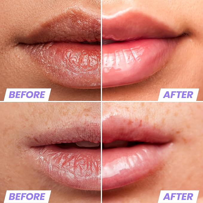 Wonderskin Lip Oil - Lip Rehab Serum Oil, Hydrating and Moisturizing Clear Serum for Dry Lips - Natural, Vegan and Non-sticky (Clear)-Velvo Beauty