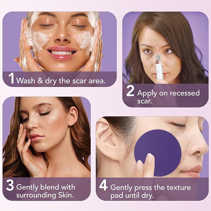 Dermaflage Scar Filler Kit - Dark - Deep Scar Cover and Waterproof Concealer for Acne Scars Wrinkles, and Ice Pick Scars Makeup, 1 mo supply-Velvo Beauty